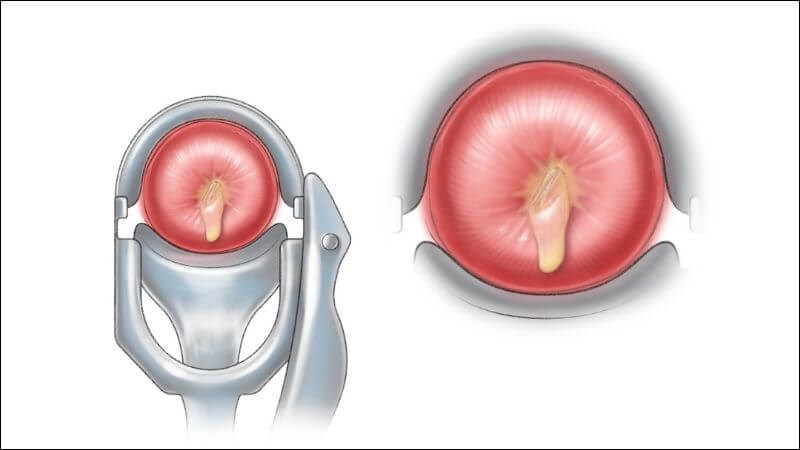 Mỹ Nhân Soi Cầu Bí Quyết Sở Hữu Vẻ Đẹp Tuyệt Vời